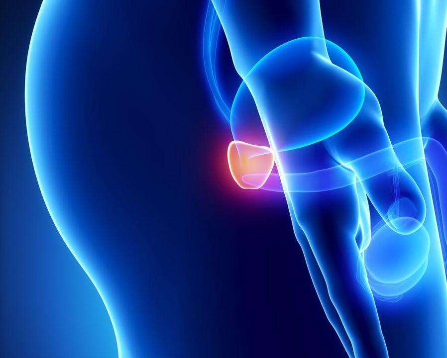 Vnetje prostate