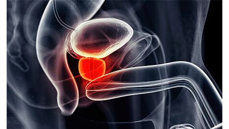 vnetje prostate